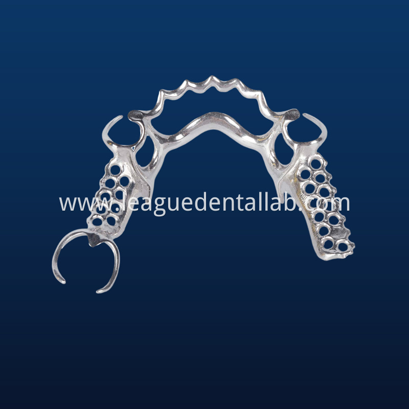 Cast partial,3D printed metal partial,Bego metal partial,cast metal framework,Vatalium Metal framework